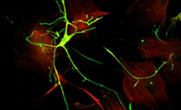 Cultured motor neurons (in green) and astrocytes (in red) from the spinal cords of ALS transgenic mice.