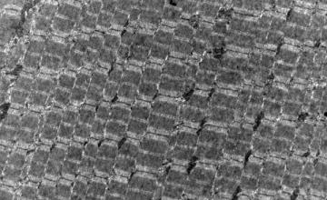 David Gokhin (DMD/BMD): In this image, taken with a microscopy technique called transmission electron microscopy, the "stair-step" pattern indicates unusually high misalignment of myofibrils (the working parts of muscle fibers) in a leg muscle from a mouse that has no gamma-actin protein.