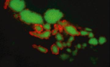 Mutant TDP43 fragments readily form aggregates (green) in mammalian cells, which are occasionally surrounded by the ubiquitin adaptor protein p62 (red).