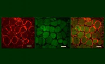 Josephine Nalbantoglu (DMD/BMD): Mouse muscles that have increased levels of proteins called transcription factors (green) produce more of the muscle protein utrophin (red) at the muscle membrane.