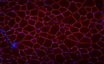 Michele Calos (DMD/BMD): Pictured a cross-section of a normal mouse leg muscle that has been stained for dystrophin, the protein missing in Duchenne muscular dystrophy. The protein, stained red, is present in the membrane around each muscle fiber. Calos and colleagues will stain for dystrophin to detect the presence of corrected cells in the muscles of mice with a with a disease resembling Duchenne muscular dystrophy after they have received stem cell injections.