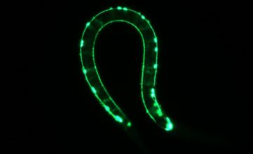 Alex Parker (ALS): Green fluorescent protein illuminates the muscle-controlling nerve cells called motor neurons in a C. elegans (nematode, or roundworm) research model of amyotrophic lateral sclerosis.
