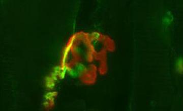 Normal neuromuscular junction (synapse) with the nerve side of the synapse stained green and the muscle side stained red. The nerve is directly applied to the muscle portion, which has a delicate pretzel shape.
