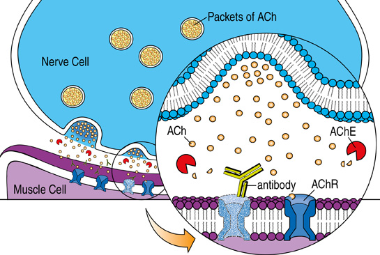 acetylcholine receptor myasthenia gravis