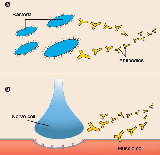 Normally (A), the immune system releases antibodies to attack foreign invaders, such as bacteria. In autoimmune diseases (B), the antibodies mistakenly attack a person’s own tissues. In myasthenia gravis, they attack and damage muscle cells.